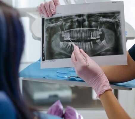 A person holding a dental x-ray.